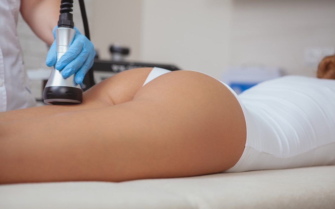 Appliances: Radio Frequency (Accent Prime), Presotherapy.