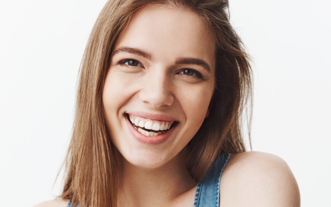 Gummy Smile