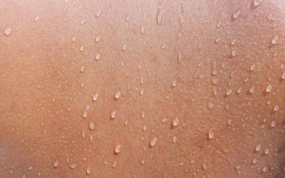 Tratamientos para lucir una piel brillante en otoño-invierno