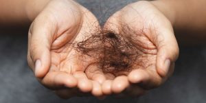 Imágenes que ilustran los tratamientos capilares innovadores para detener la caída del cabello