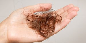 Visualiza la transformación de la piel a través de tratamientos específicos para el otoño e invierno ¿Te preocupa la pérdida de cabello No te dejes engañar por los mitos. Lee nuestro artículo y encuentra soluciones efectivas