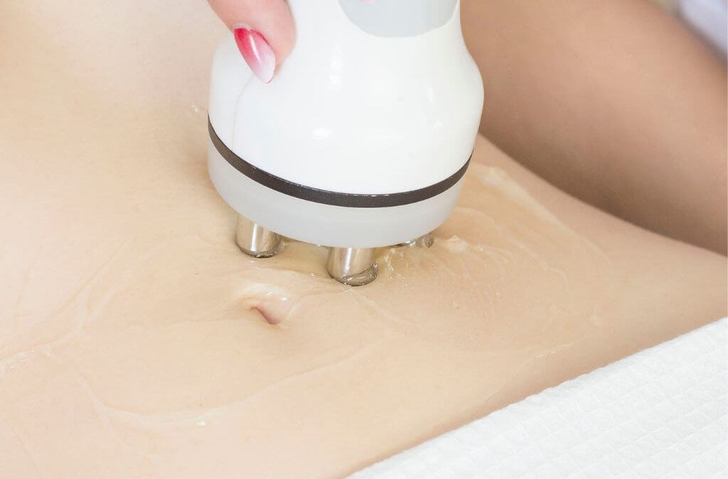 Descubre la transformación estética: Qué es la radiofrecuencia corporal en Oliva Clinic