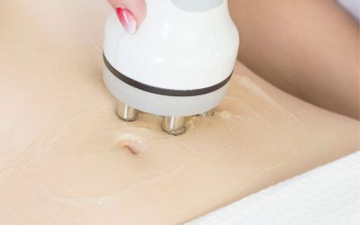 Descubre la transformación estética: Qué es la radiofrecuencia corporal en Oliva Clinic