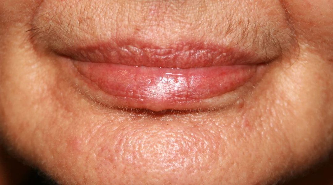 ¿Cómo eliminar el código de barras del labio superior?