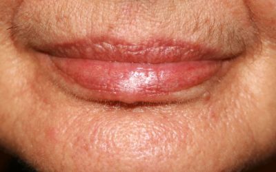 ¿Cómo eliminar el código de barras del labio superior?